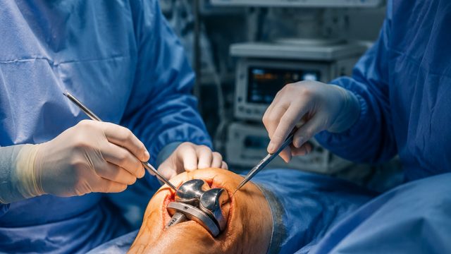 Innovative Technology Set to Transform Treatment for Implant Infections | rtp bos717, free online ga Innovative Technology Set to Transform Treatment for Implant Infections | rtp bos717, free online ga